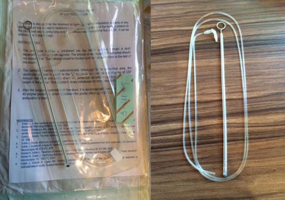 Implantan experimento médico ilegal a 194 mexicanos - 1449711957_158200_1449771714_sumario_grande